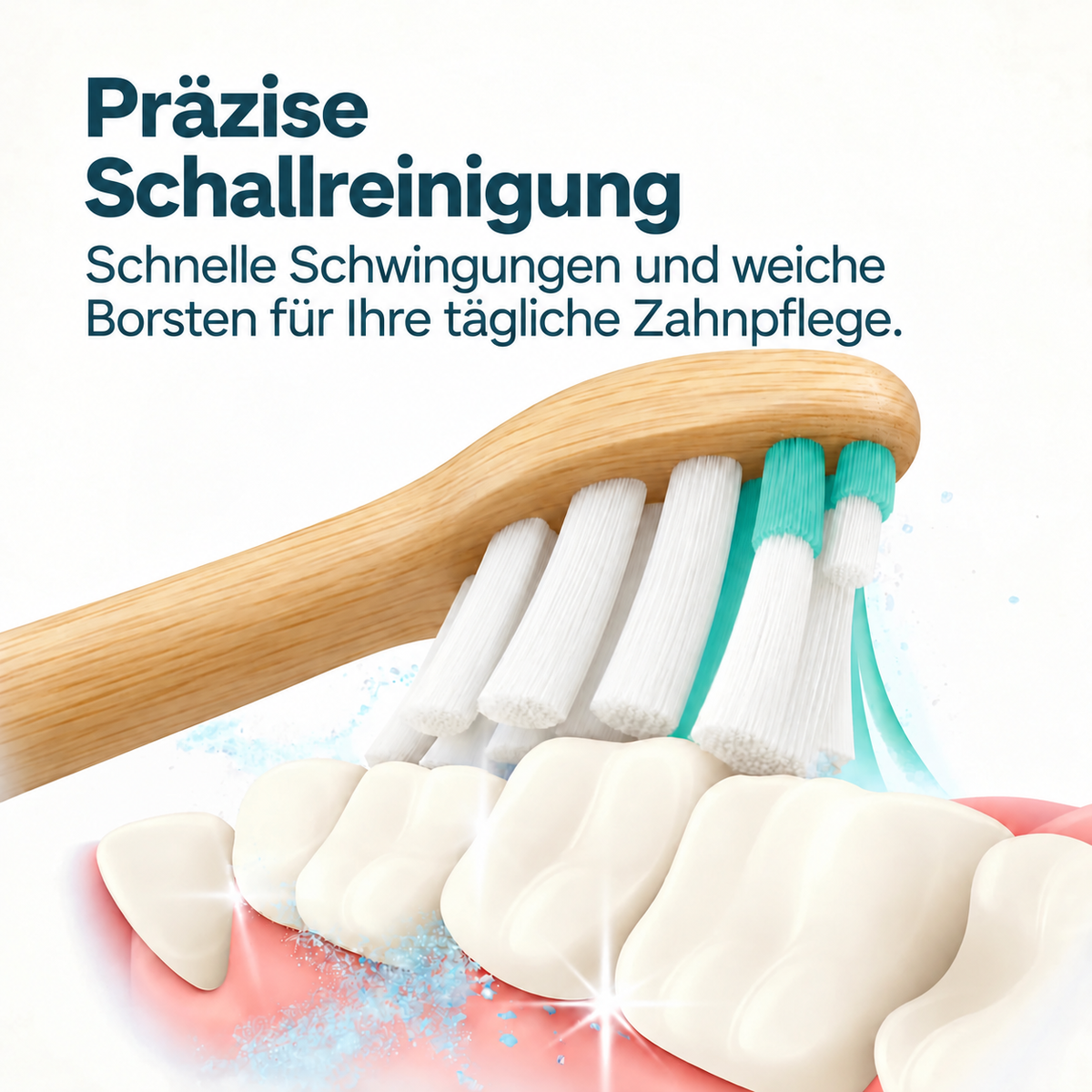 Illustration der Schallreinigung mit weichen Borsten